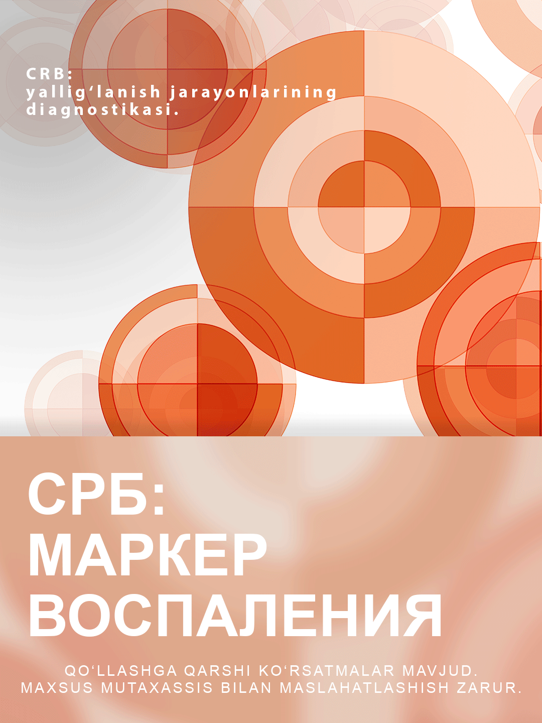 С-реактивный белок (СРБ) в Swiss Lab